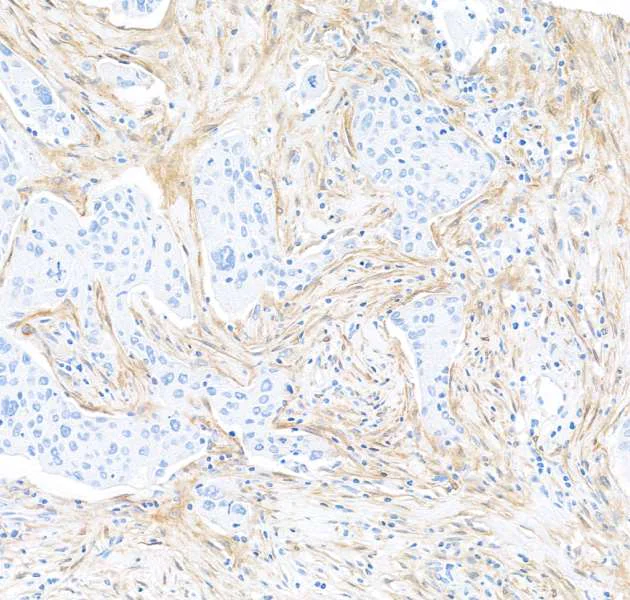 Immunohistochemistry - Anti-Fibroblast Activation Protein alpha/FAP antibody [BLR150J] - BSA free (AB314075)