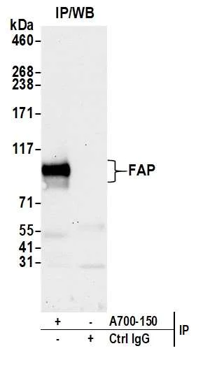 Immunoprecipitation - Anti-Fibroblast Activation Protein alpha/FAP antibody [BLR150J] - BSA free (AB314075)