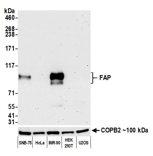 Western blot - Anti-Fibroblast Activation Protein alpha/FAP antibody [BLR150J] - BSA free (AB314075)