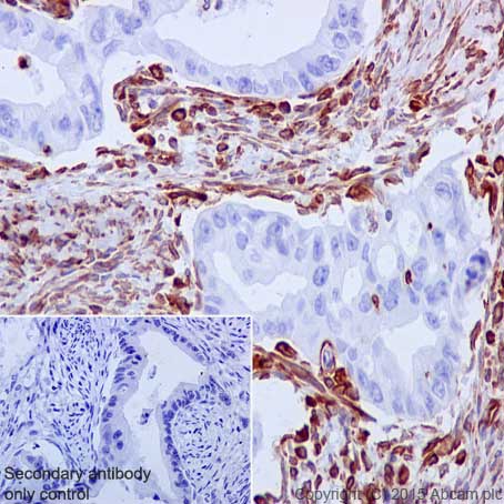 Immunohistochemistry (Formalin/PFA-fixed paraffin-embedded sections) - Fibroblast Marker (Vimentin, alpha smooth muscle Actin, Hsp47, S100A4) Antibody Panel - Human, Mouse (ab254015), expandable thumbnail