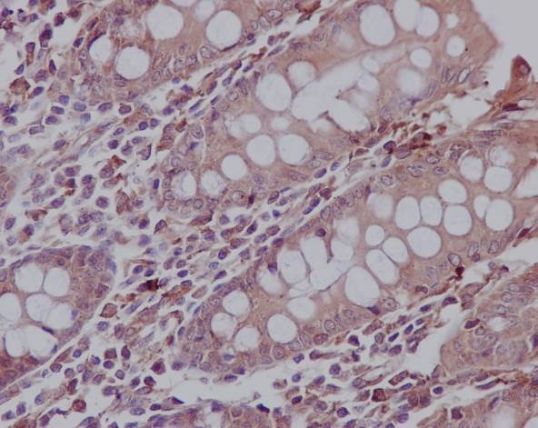 Immunohistochemistry (Formalin/PFA-fixed paraffin-embedded sections) - Fibroblast Marker (Vimentin, alpha smooth muscle Actin, Hsp47, S100A4) Antibody Panel - Human, Mouse (AB254015), expandable thumbnail