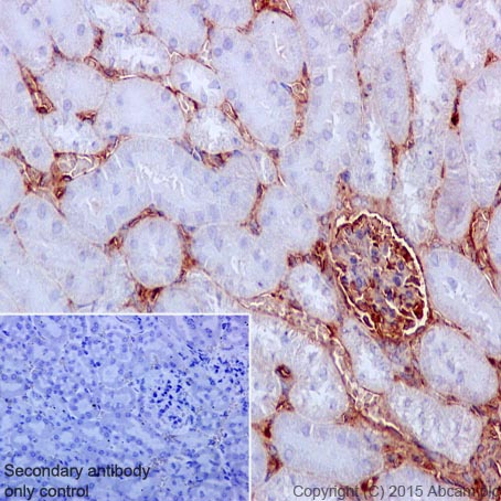 Immunohistochemistry (Formalin/PFA-fixed paraffin-embedded sections) - Fibroblast Marker (Vimentin, alpha smooth muscle Actin, Hsp47, S100A4) Antibody Panel - Human, Mouse (ab254015), expandable thumbnail