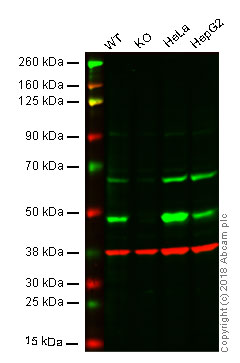 Western blot - Fibroblast Marker (Vimentin, alpha smooth muscle Actin, Hsp47, S100A4) Antibody Panel - Human, Mouse (ab254015), expandable thumbnail