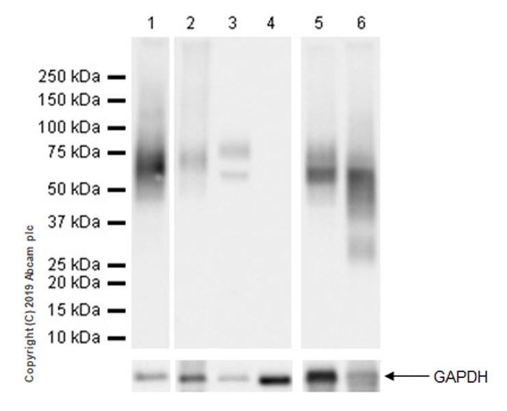 Western blot - Anti-Fibromodulin antibody [EPR23029-174] (AB267465), expandable thumbnail