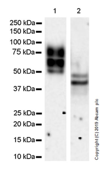 Western blot - Anti-Fibromodulin antibody [EPR23029-174] (AB267465), expandable thumbnail