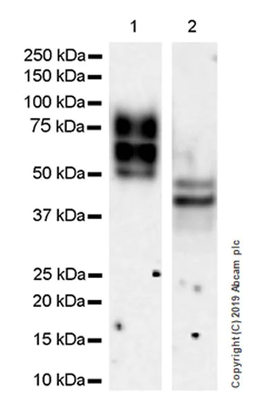 Western blot - Anti-Fibromodulin antibody [EPR23029-174] (AB267465)