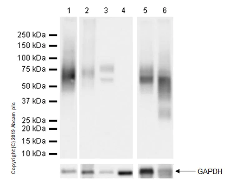 Western blot - Anti-Fibromodulin antibody [EPR23029-174] - BSA and Azide free (AB269866)