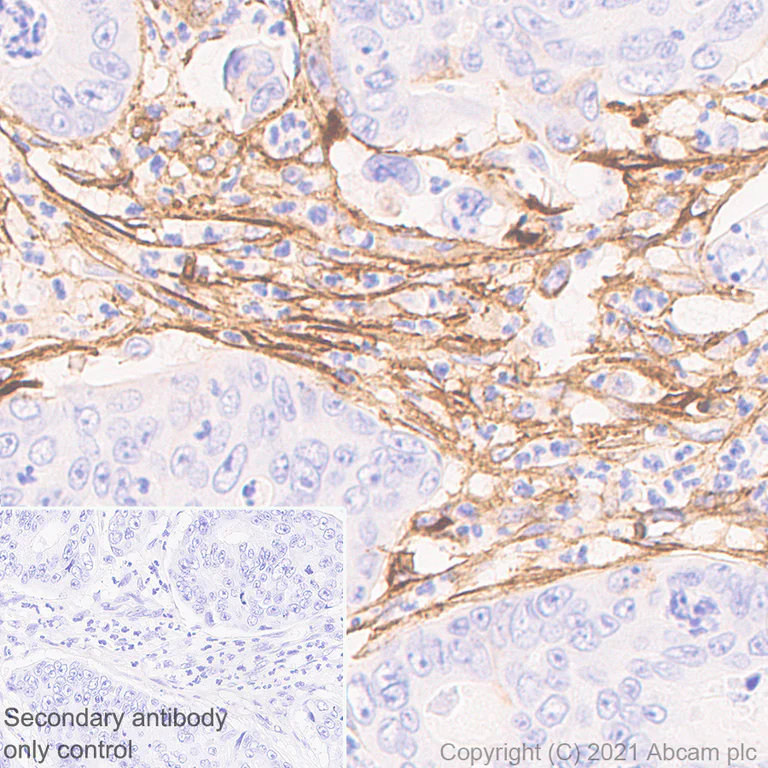 Immunohistochemistry (Formalin/PFA-fixed paraffin-embedded sections) - Anti-Fibronectin antibody [10/Fibronectin] - BSA and Azide free (AB281577)