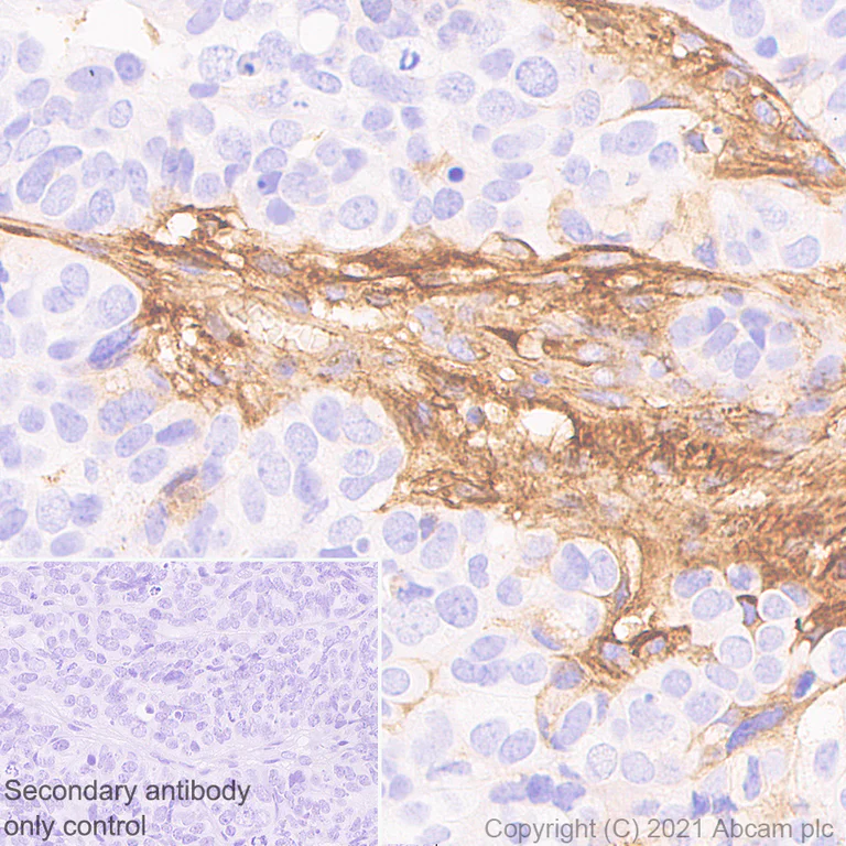Immunohistochemistry (Formalin/PFA-fixed paraffin-embedded sections) - Anti-Fibronectin antibody [10/Fibronectin] - BSA and Azide free (AB281577)