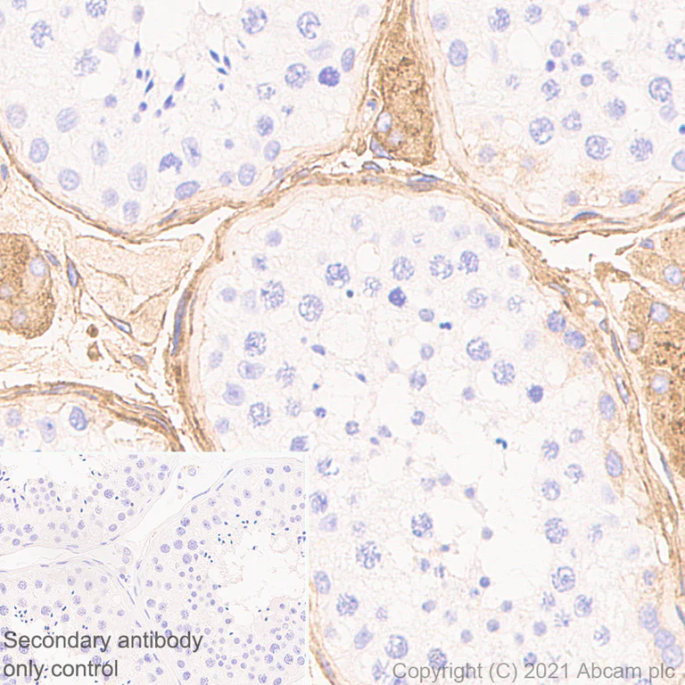 Immunohistochemistry (Formalin/PFA-fixed paraffin-embedded sections) - Anti-Fibronectin antibody [10/Fibronectin] - BSA and Azide free (AB281577)