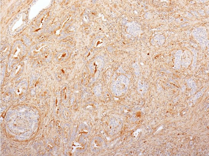Immunohistochemistry (Formalin/PFA-fixed paraffin-embedded sections) - Anti-Fibronectin antibody [616] (AB270240), expandable thumbnail