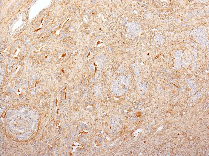 Immunohistochemistry (Formalin/PFA-fixed paraffin-embedded sections) - Anti-Fibronectin antibody [616] (AB270240)