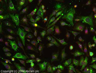 Immunocytochemistry/ Immunofluorescence - Anti-Fibronectin antibody (AB2413)