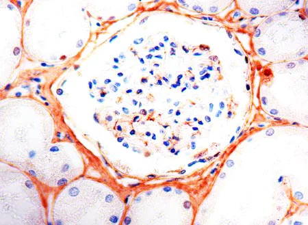 Immunohistochemistry (Formalin/PFA-fixed paraffin-embedded sections) - Anti-Fibronectin antibody (AB2413)