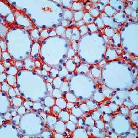 Immunohistochemistry (Formalin/PFA-fixed paraffin-embedded sections) - Anti-Fibronectin antibody (AB2413)