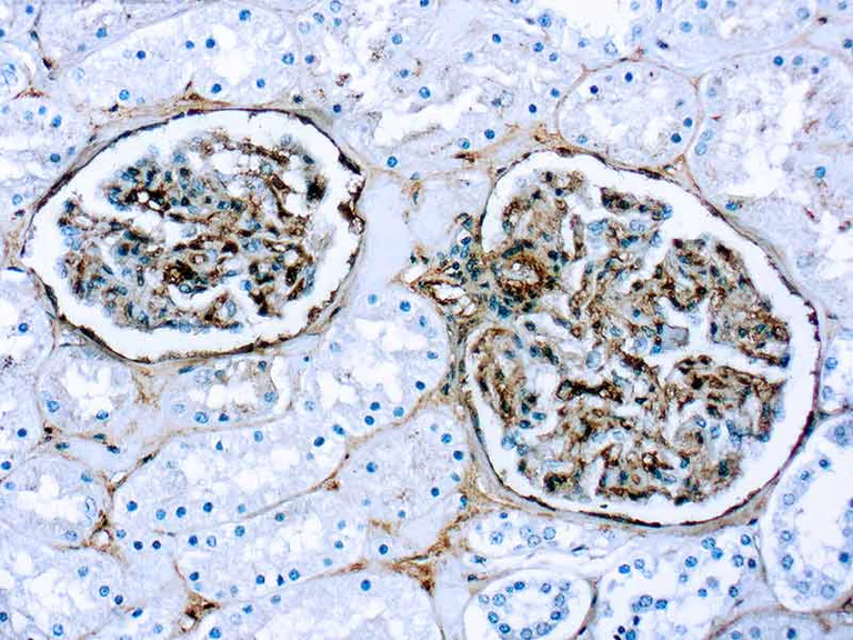 Immunohistochemistry (Formalin/PFA-fixed paraffin-embedded sections) - Anti-Fibronectin antibody (AB2413)