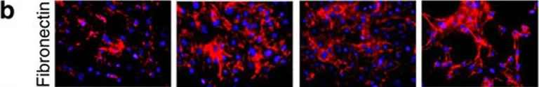 Immunohistochemistry - Anti-Fibronectin antibody (AB2413)