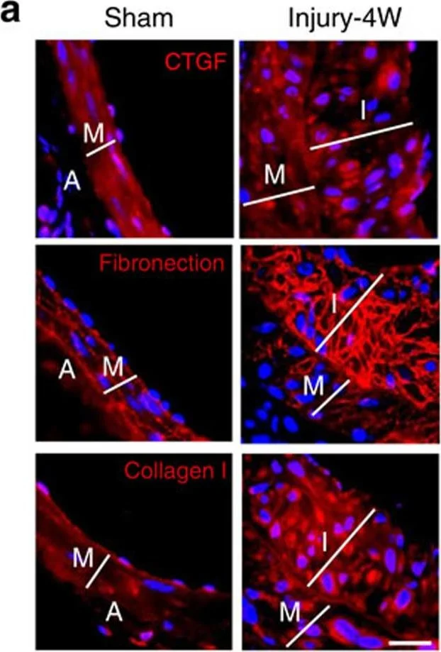 Immunohistochemistry - Anti-Fibronectin antibody (AB2413)