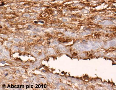 Immunohistochemistry (Formalin/PFA-fixed paraffin-embedded sections) - Anti-Fibronectin antibody - BSA and Azide free (AB23750)