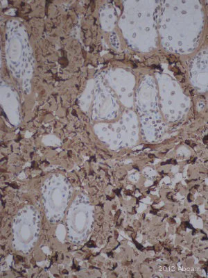 Immunohistochemistry (Formalin/PFA-fixed paraffin-embedded sections) - Anti-Fibronectin antibody - BSA and Azide free (AB23750)