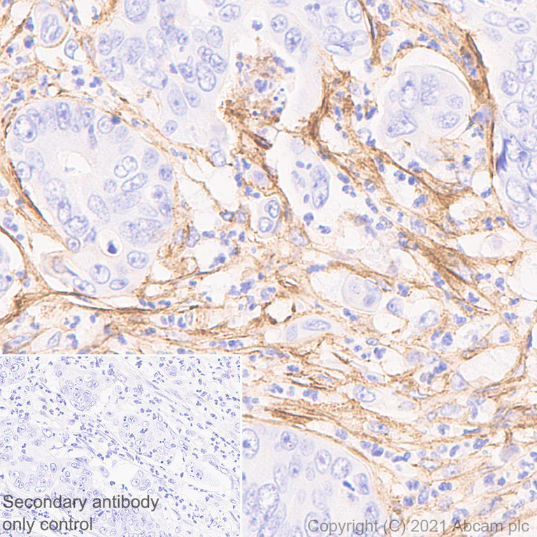 Immunohistochemistry (Formalin/PFA-fixed paraffin-embedded sections) - Anti-Fibronectin antibody [EP-5] - BSA and Azide free (AB281576)