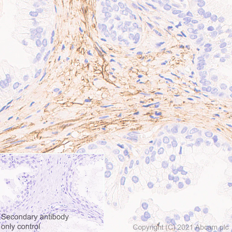 Immunohistochemistry (Formalin/PFA-fixed paraffin-embedded sections) - Anti-Fibronectin antibody [EP-5] - BSA and Azide free (AB281576)