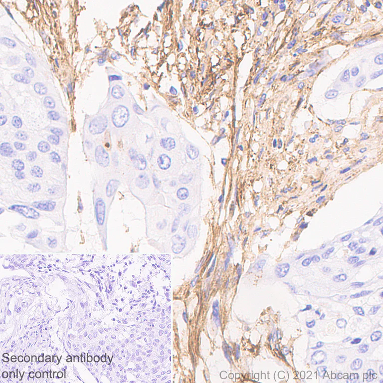 Immunohistochemistry (Formalin/PFA-fixed paraffin-embedded sections) - Anti-Fibronectin antibody [EP-5] - BSA and Azide free (AB281576)