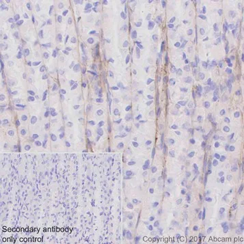 Immunohistochemistry (Formalin/PFA-fixed paraffin-embedded sections) - Anti-Fibronectin antibody [EPR19241-46] - BSA and Azide free (AB224689)
