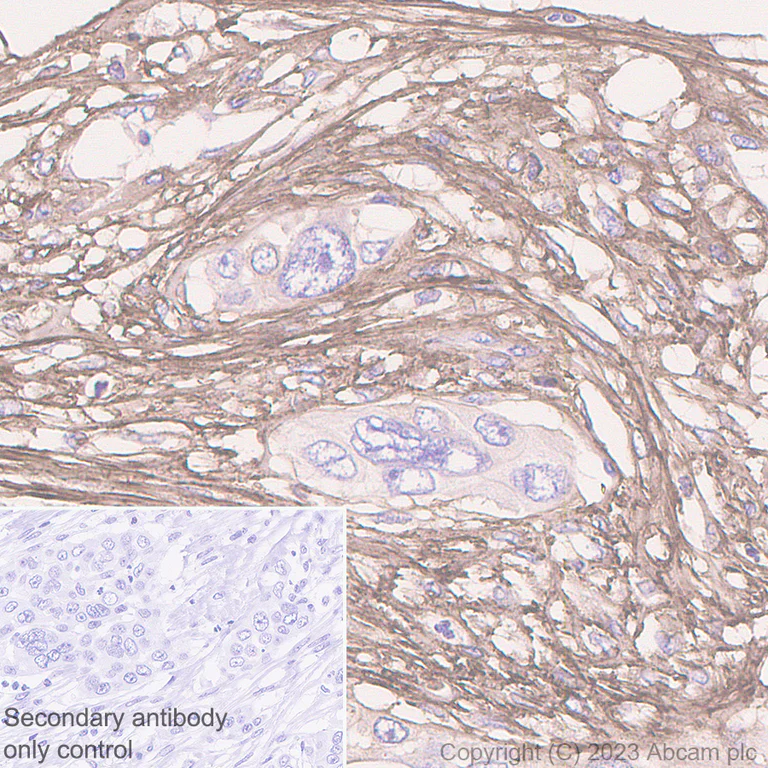 Immunohistochemistry (Formalin/PFA-fixed paraffin-embedded sections) - Anti-Fibronectin antibody [EPR23110-25] - BSA and Azide free (AB268023)