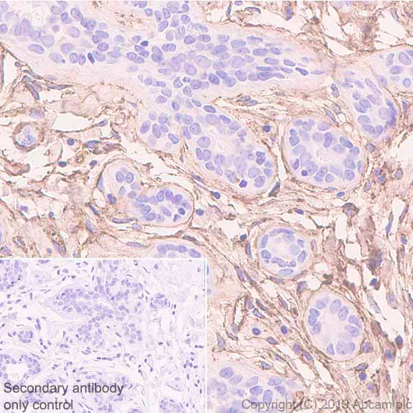 Immunohistochemistry (Formalin/PFA-fixed paraffin-embedded sections) - Anti-Fibronectin antibody [EPR23110-25] - BSA and Azide free (AB268023)