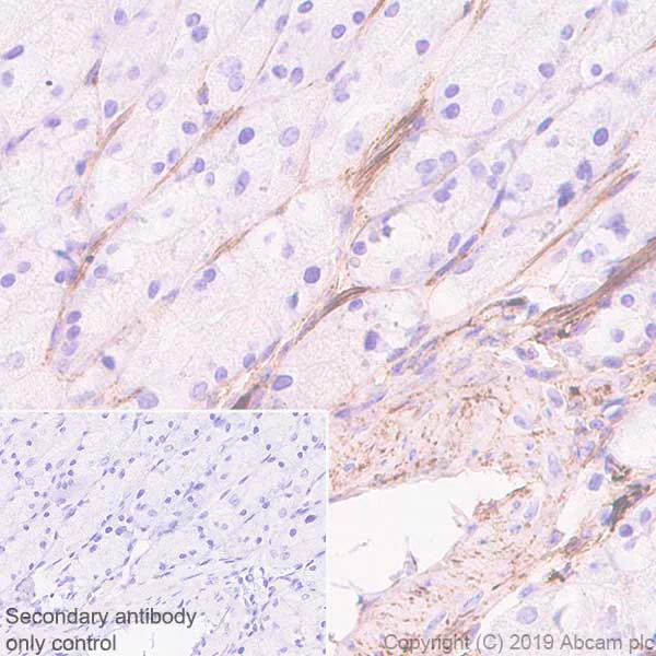 Immunohistochemistry (Formalin/PFA-fixed paraffin-embedded sections) - Anti-Fibronectin antibody [EPR23110-25] - BSA and Azide free (AB268023)