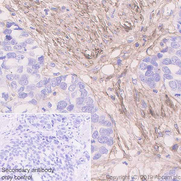 Immunohistochemistry (Formalin/PFA-fixed paraffin-embedded sections) - Anti-Fibronectin antibody [EPR23110-25] - BSA and Azide free (AB268023)