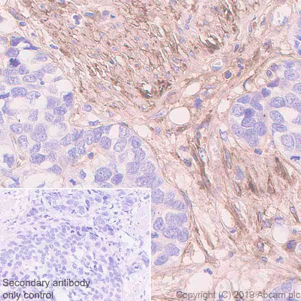 Immunohistochemistry (Formalin/PFA-fixed paraffin-embedded sections) - Anti-Fibronectin antibody [EPR23110-25] - BSA and Azide free (AB268023)