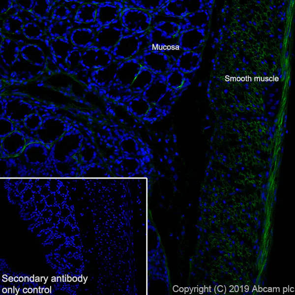 Immunohistochemistry (Frozen sections) - Anti-Fibronectin antibody [EPR23110-25] - BSA and Azide free (AB268023)