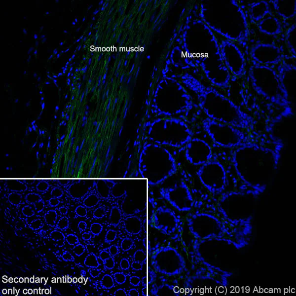 Immunohistochemistry (Frozen sections) - Anti-Fibronectin antibody [EPR23110-25] - BSA and Azide free (AB268023)