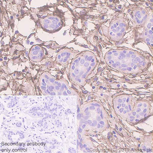 Immunohistochemistry (Formalin/PFA-fixed paraffin-embedded sections) - Anti-Fibronectin antibody [EPR23110-46] (AB268020), expandable thumbnail