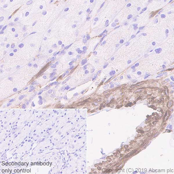Immunohistochemistry (Formalin/PFA-fixed paraffin-embedded sections) - Anti-Fibronectin antibody [EPR23110-46] (AB268020), expandable thumbnail