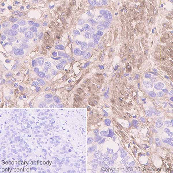 Immunohistochemistry (Formalin/PFA-fixed paraffin-embedded sections) - Anti-Fibronectin antibody [EPR23110-46] (AB268020), expandable thumbnail