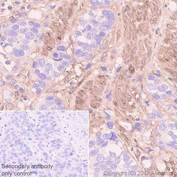 Immunohistochemistry (Formalin/PFA-fixed paraffin-embedded sections) - Anti-Fibronectin antibody [EPR23110-46] (AB268020)