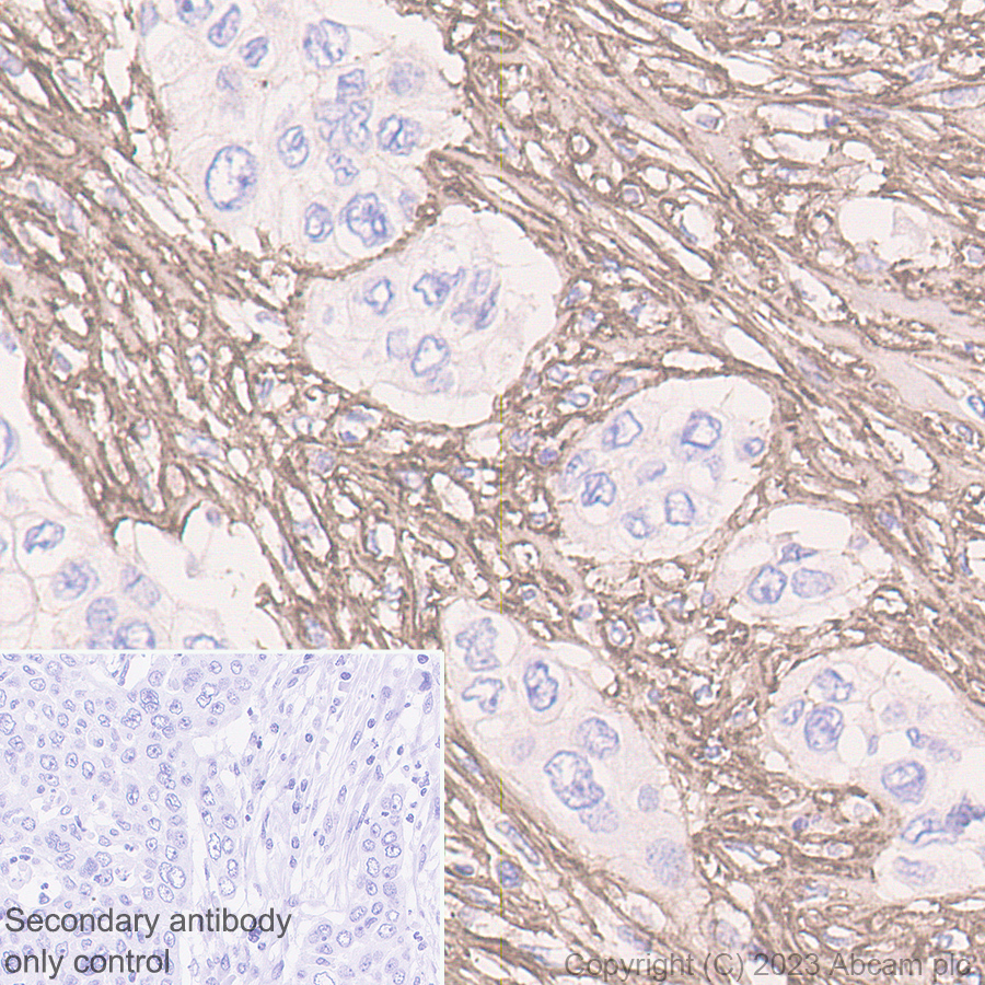 Immunohistochemistry (Formalin/PFA-fixed paraffin-embedded sections) - Anti-Fibronectin antibody [EPR23110-46] (ab268020), expandable thumbnail