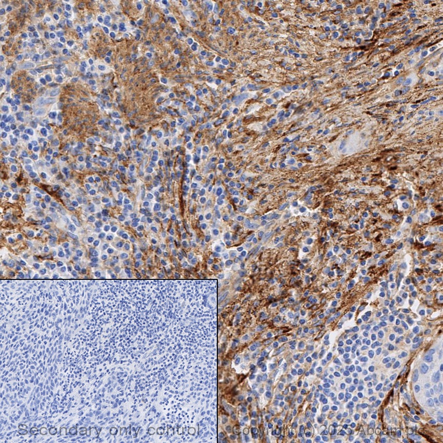 Immunohistochemistry (Formalin/PFA-fixed paraffin-embedded sections) - Anti-Fibronectin antibody [EPR23110-46] (ab268020), expandable thumbnail