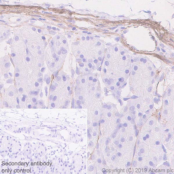 Immunohistochemistry (Formalin/PFA-fixed paraffin-embedded sections) - Anti-Fibronectin antibody [EPR23110-46] (AB268020), expandable thumbnail