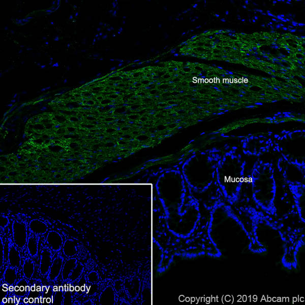 Immunohistochemistry (Frozen sections) - Anti-Fibronectin antibody [EPR23110-46] (ab268020), expandable thumbnail