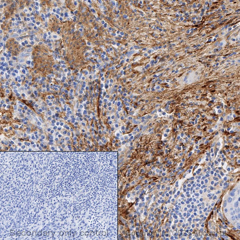 Immunohistochemistry (Formalin/PFA-fixed paraffin-embedded sections) - Anti-Fibronectin antibody [EPR23110-46] - BSA and Azide free (AB268022)