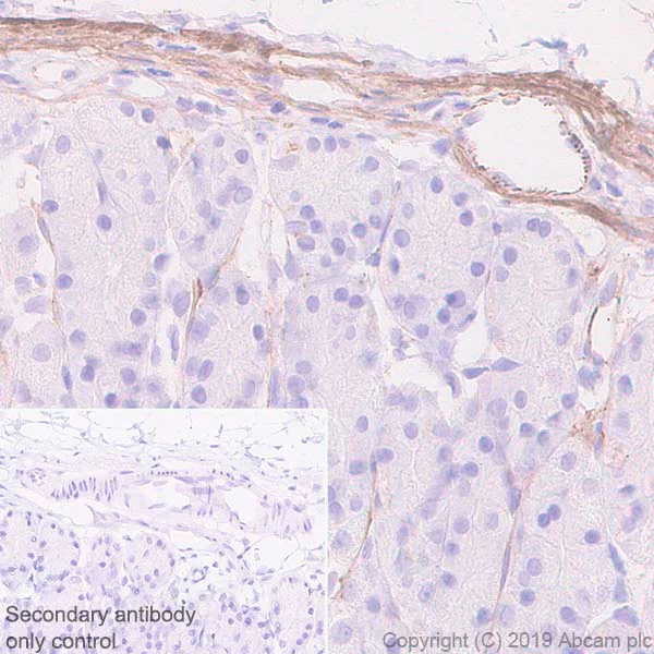 Immunohistochemistry (Formalin/PFA-fixed paraffin-embedded sections) - Anti-Fibronectin antibody [EPR23110-46] - BSA and Azide free (AB268022)