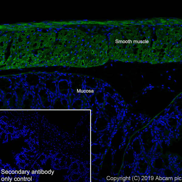 Immunohistochemistry (Frozen sections) - Anti-Fibronectin antibody [EPR23110-46] - BSA and Azide free (AB268022)
