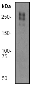 Western blot - Anti-Fibronectin antibody [F14] (AB45688)