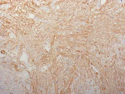 Immunohistochemistry (Formalin/PFA-fixed paraffin-embedded sections) - Anti-Fibronectin antibody [HFN7.1] - BSA and Azide free (AB212371)