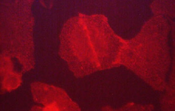 Immunocytochemistry/ Immunofluorescence - Anti-Fibronectin antibody [M013] (AB253287), expandable thumbnail