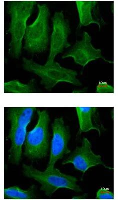 Immunocytochemistry/ Immunofluorescence - Anti-Fibronectin antibody - N-terminal (AB137720)